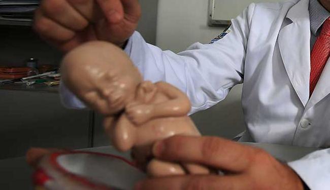 Segundo o Ministério da Saúde, 3.852 casos suspeitos de microcefalia são investigados no país (Foto: Joa Souza | Ag. A TARDE)