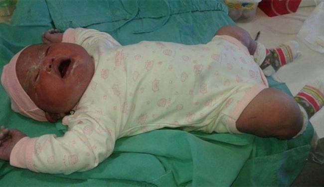 Olívia nasceu nesta segunda-feira, 15, de cesariana e passa bem (Foto: Reprodução Facebook l Miguel Angel Parra)