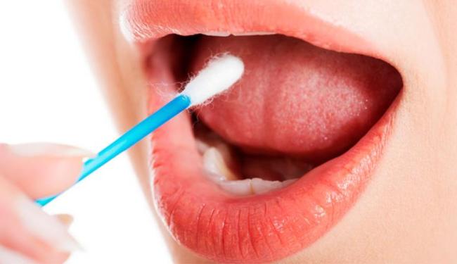 Pesquisadores brasileiros identificaram vírus em amostras de saliva