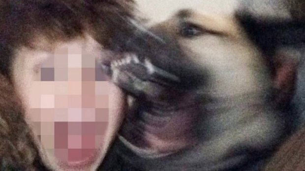 Momento em que o cachorro morde o menino de 11 anos foi registrado pela própria vítima (Foto: Reprodução/Snapchat)
