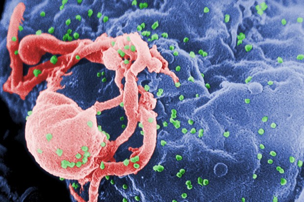 Imagem de microscópio eletrônico mostra vírus HIV em superfície de célula (Foto: Cynthia Goldsmith/Centers for Disease Control and Prevention via AP)