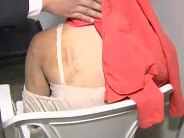 Adolescente foi torturada, agredida e esfaqueada por rivais (Foto: Reprodução/TV Anhamguera)