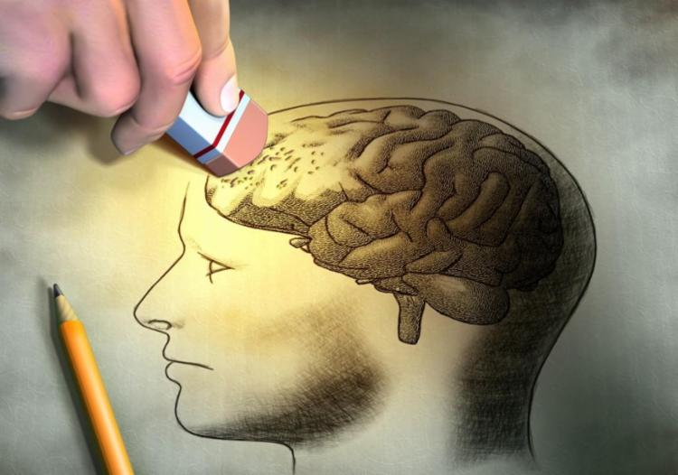 Alzheimer é uma doença que causa perda de memória (Foto: Divulgação)