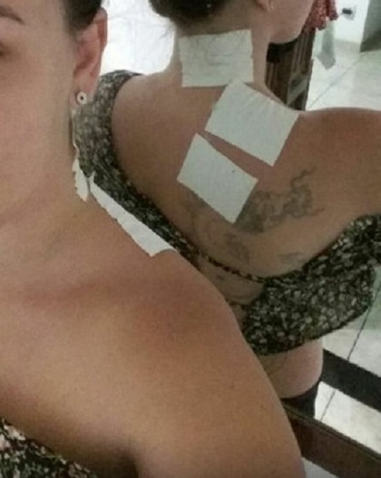 Briana Jung apelou por salonpas para tratar a dor (Foto: Acervo pessoal)