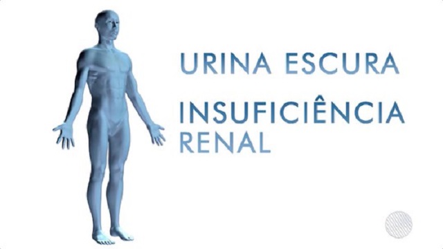 É importante que o paciente não tome anti-inflamatório para não piorar a situação dos rins (Foto: Reprodução)