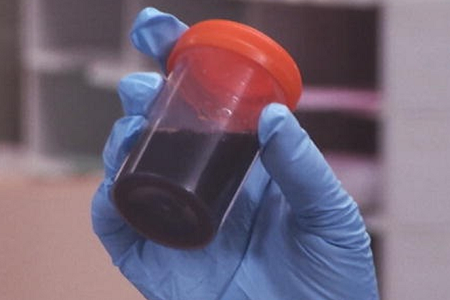 Pesquisadores analisam amostras e evidências anteriores para tentar descobrir causa de surto na Bahia e, agora, de casos suspeitos no Ceará (Foto: Reprodução)
