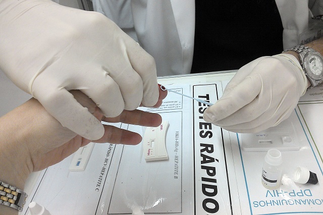 Saber do contágio pelo HIV precocemente aumenta a expectativa de vida do soropositivo