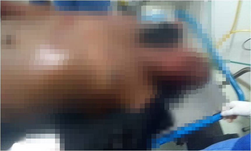 Imediatamente, o PM solicitou o bloqueio da pista e uma viatura da CIPE-POLO realizou a interceptação do veículo roubado.