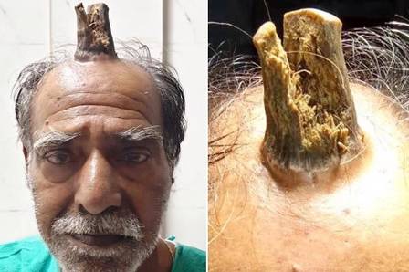Por causa da raridade, o caso será relatado na revista 'International Journal of Surgery' - Foto: Reprodução