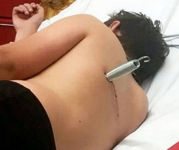 Jovem estava praticando saltos no quintal da casa de um amigo no momento do incidente