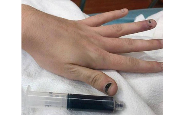 Mulher deu entrada na emergência do hospital reclamando de fraqueza, fadiga e dificuldade para respirar (Foto: Reprodução)