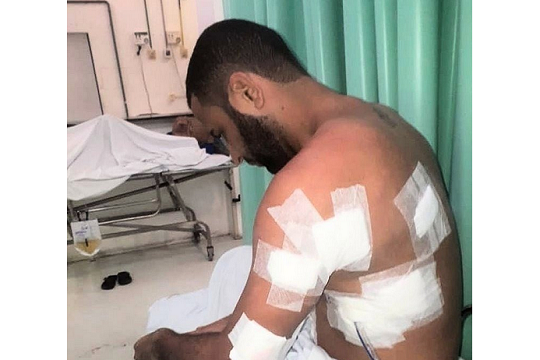 Marcelo Macedo foi agredido com socos e chutes antes dos tiros (Foto: Reprodução)