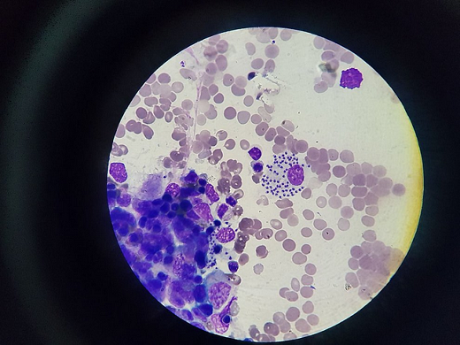 Parasita já infectou mais de 100 pessoas no Nordeste, sobretudo em Sergipe (Foto: Divulgação)