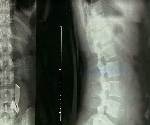 Rafaela sofria com dores na barriga e anda com remédios para enjoos e analgésicos desde que deu à luz, há quatro anos (Foto: Reprodução | EPTV)