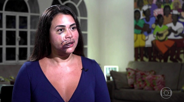 Corretora Milka Borges ficou com o rosto desfigurado (Foto: Reprodução)