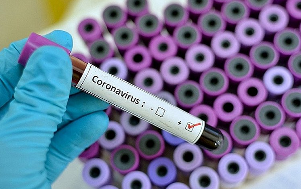 Confirmados 13 novos casos de contaminação pelo novo coronavírus no estado (Foto: Reprodução)