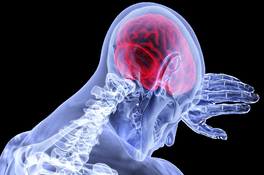 Pacientes com covid-19 e idade abaixo da do grupo de risco têm sofrido AVCs (Foto: Reprodução)