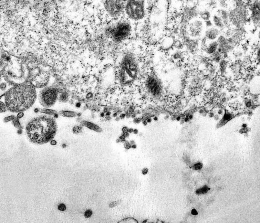 Diversas partículas do novo coronavírus (pontos mais escuros) atacando as células (Foto: Débora F. Barreto-Vieira | IOC | Fiocruz)