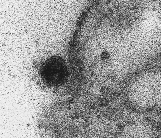 A imagem mostra, em detalhes, o novo coronavírus (ponto escuro maior à esquerda) atacando a membrana de uma célula (linha mais escura à direita) (Foto: Débora F. Barreto -Vieira | IOC | Fiocruz)