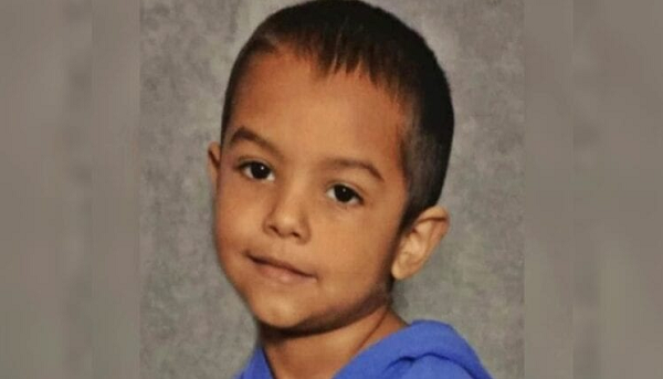 Deshaun, de 6 anos, pesava pouco mais de 8 kg (Foto: Reprodução)