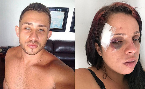 Jamile denunciou o lutador de jiu-jitsu Felipe Andrade Alves Nunes, 25 anos, por agressão (Foto: Reprodução)