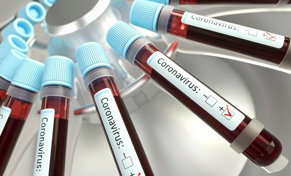 50 óbitos são confirmados no município (Foto: Reprodução)