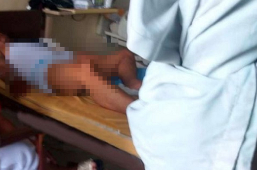 Trombose peniana foi diagnosticada em um paciente com Covid-19 (Foto: Reprodução)