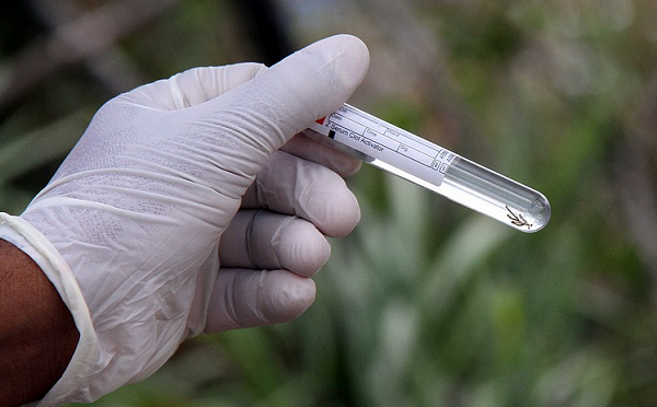 Sozinha, a Bahia concentra praticamente metade dos casos de chikungunya no país com 49,6% dos registros (Foto: Reprodução)
