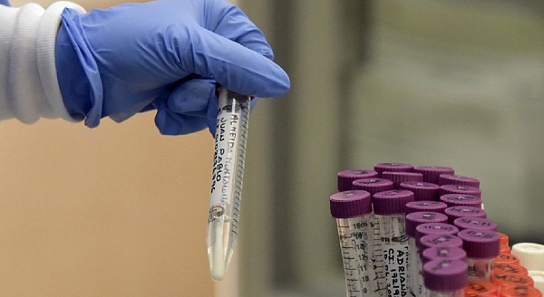 Evidências de reinfecção pelo novo coronavírus são fortes nos dois casos analisados (Foto: Reprodução)
