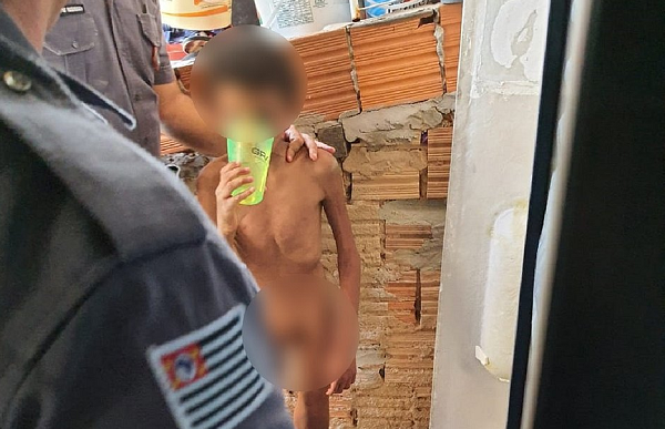 Garoto de 11 anos pesa cerca de 25kg (Foto: Divulgação)