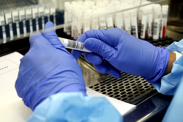 Segundo especialistas, a nova cepa tem chances de ser mais transmissível e letal do que a covid-19 (Foto: Reprodução)