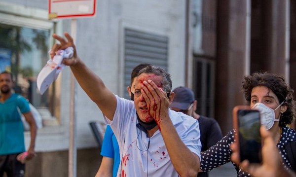 Daniel Campelo da Silva, de 51 anos, perdeu a visão do olho atingido por um tiro de bala de borracha (Foto: Reprodução)