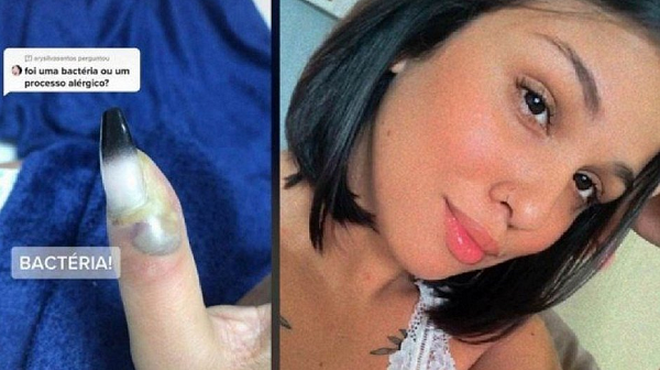Caso ocorreu quando Jenneffer Souza realizou manutenção das unhas de acrigel (Foto: Reprodução)