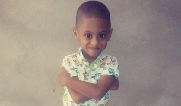 Menino de seis anos mora em Feira de Santana e tem anomalia congênita (Foto: Arquivo Pessoal)