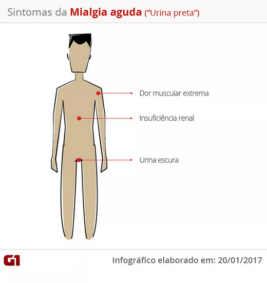 Infográfico - Sintomas da 'doença da urina preta' (Foto: Reprodução/G1)