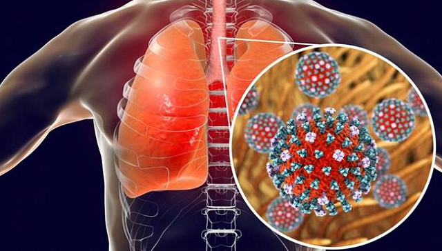 De acordo com a Sesab, 15 pessoas evoluíram para Síndrome Respiratória Aguda Grave (SRAG) e estão internadas (Foto: Reprodução)