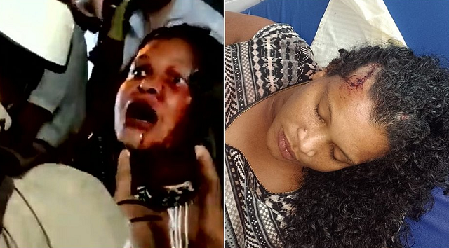 A indígena agredida por policiais militares voltou a passar mal e precisou ser internada (Foto: Reprodução)