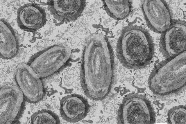 A doença foi diagnosticada pela primeira vez em humanos, em 1970 - Foto: Reprodução