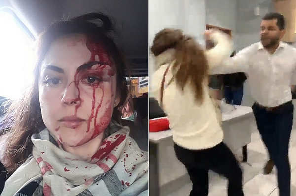 Procuradora foi espancada e ficou com o rosto completamente ensanguentado (Foto: Reprodução/Redes Sociais)