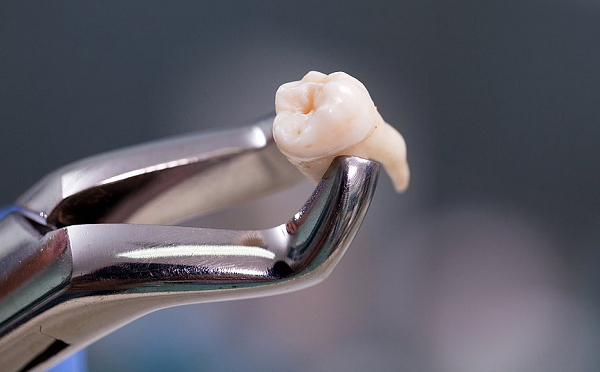 Durante a cirurgia de retirada do dente, Roseli passou mal, chegou a ser levada à um hospital, mas não resistiu e morreu no mesmo dia (Foto: Reprodução)