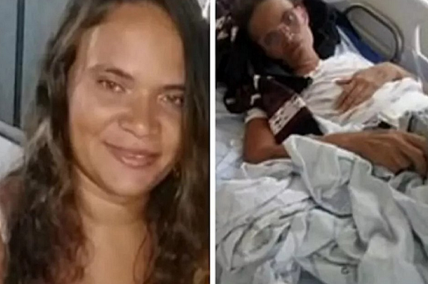 Foto do antes e depois de Deliane ter sido internada (Foto: Acervo pessoal)