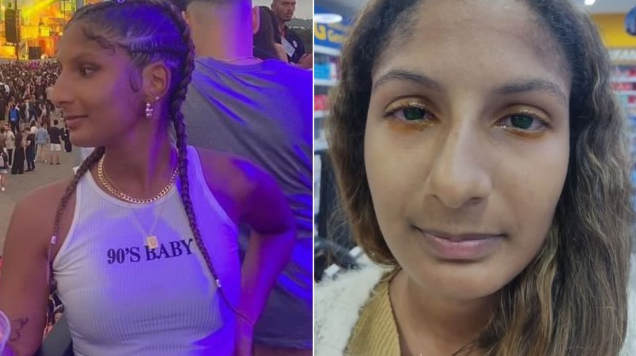 Antes e depois. Yasmin Alarcão, de 27 anos sofreu queimadura da córnea com produtos usados para trançar o cabelo (Foto: Arquivo pessoal)