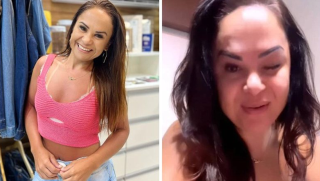 Empresária fez botox dia 16 de novembro e, desde então, não consegue abrir os olhos (Foto: Bnews/Divulgação Reprodução/Redes sociais)