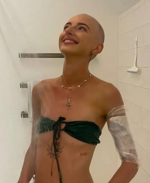 Poppy Beguely na fase de luta contra o câncer (Foto: Arquivo pessoal)