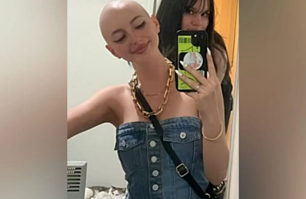 Poppy Beguely durante o tratamento contra o linfoma (Foto: Arquivo pessoal)