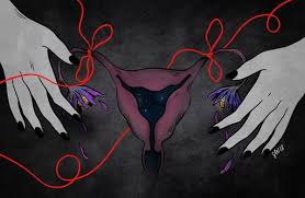 Os critérios vigentes também se aplicam a homens. No caso delas, a realização de laqueadura é restringida a ter, no mínimo, dois filhos - Reprodução