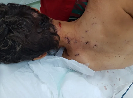Marcas das facadas pelo corpo da motorista por aplicativo (Foto: Arquivo Pessoal)  