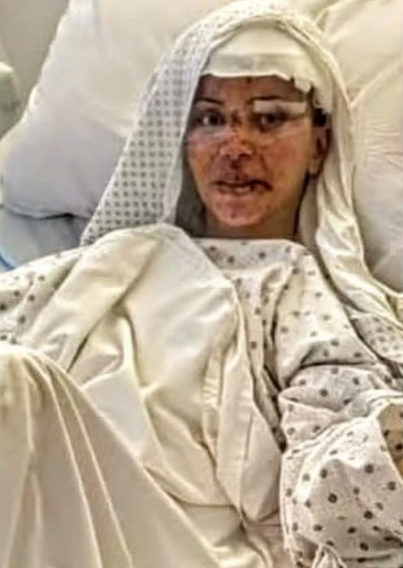 Fatima Bustani após a cirurgia de reconstrução da face, num hospital libanês (Foto: Reprodução)