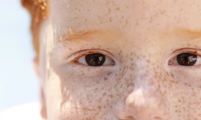 Sintomas podem ser detectados em fotos tiradas com flash (Foto: Bruno Peres/Agência Brasil)