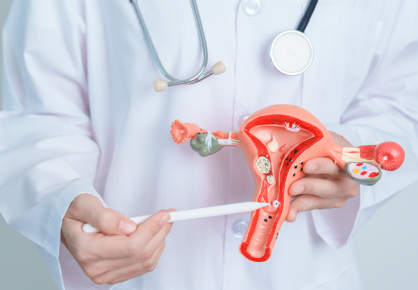 Detecção precoce pode ser feita por meio do exame Papanicolau, mais conhecido como preventivo, disponível na rede pública de saúde (Foto: Reprodução)